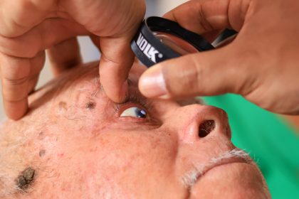 Prefeitura de Riachão realiza Mutirão de Glaucoma e amplia acesso à saúde visual
